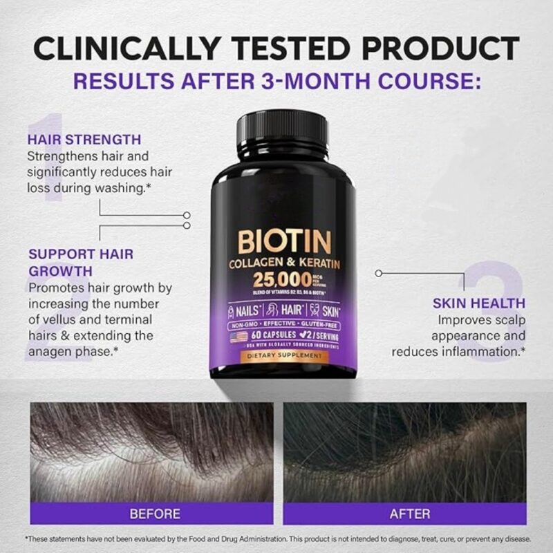 Biotin Capsules for Hair and Skin - High-Quality Nutritional Supplements - Image 2